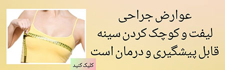 عوارض کوچک کردن سینه عوارض پروتز سینه,عوارض عمل لیفت,کوچک کردن سینه