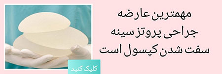پروتز سینه عوارض پروتز سینه,عوارض عمل لیفت,کوچک کردن سینه