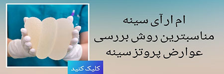 جراحی زیبایی لیفت عوارض پروتز سینه,عوارض عمل لیفت,کوچک کردن سینه