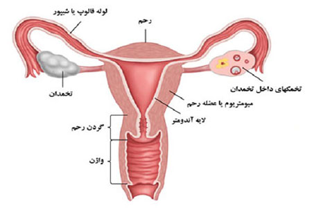 تقویت رحم,تقویت رحم برای بارداری,راهکارهای تقویت رحم