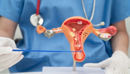 لکه بینی بین دو قاعدگی