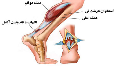  تاندون آشیل, عضلات تاندون آشیل