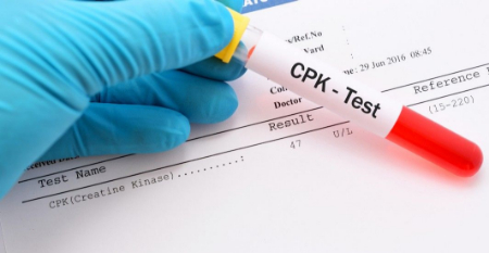 آزمایش CPK, نحوه انجام آزمایش CPK