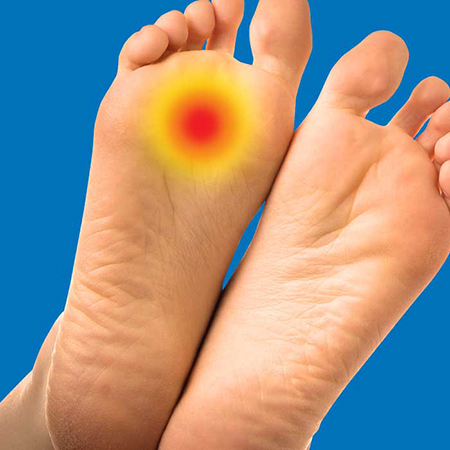 علت درد پنجه پا, درمان درد پنجه پا در طب سنتی, علت درد زیر انگشتان کف پا