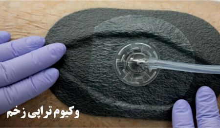 وکیوم تراپی زخم عفونی