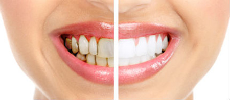 ترمیم و زیبایی دندان