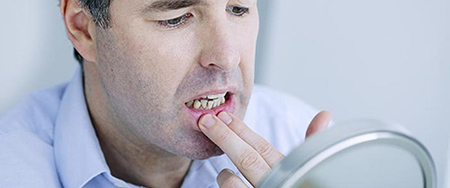 چگونه دندان درد را آرام کنیم,علت دندان درد