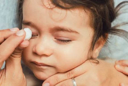 درمان قی چشم کودک برای قی چشم چی خوبه