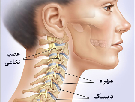 محل قرار گیری دیسک گردن