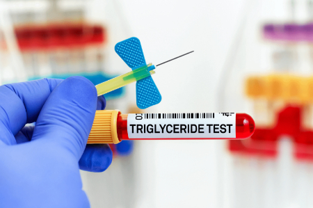 آزمایش تری گلیسرید چیست, TG در آزمایش خون چیست