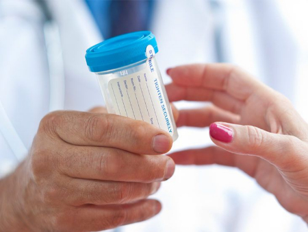 آزمایش سیتولوژی ادرار چیست, تشخیص سرطان مثانه با سیتولوژی ادرار