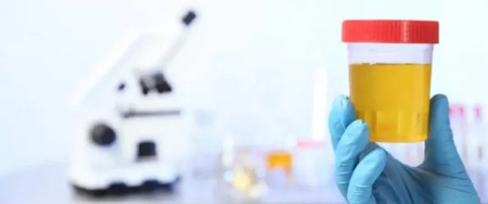 نحوه نمونه گیری ادرار