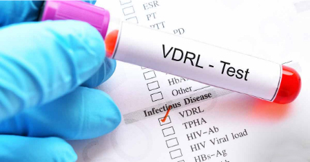  آزمایش VDRL چیست, آزمایش VDRL در بارداری