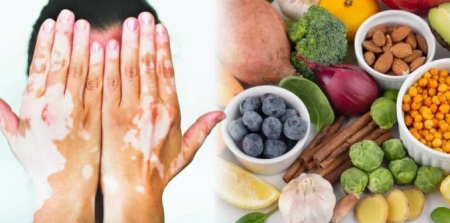 غذا برای درمان پپسی