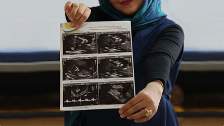 روش هایی برای اعلام خبر بارداری,راههایی برای اعلام خبر بارداری