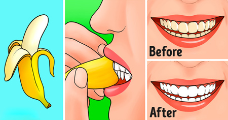 نحوه سفید کردن دندان با پوست موز,مهارت های استفاده از پوست موز