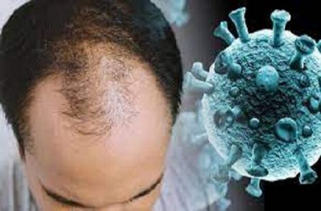ژن طاسی ،اخبار پزشکی ،خبرهای پزشکی ژن طاسی,اخبار پزشکی ,خبرهای پزشکی