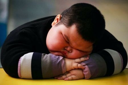 چاقی ،اخبار پزشکی ،خبرهای پزشکی چاقی ,اخبار پزشکی ,خبرهای پزشکی
