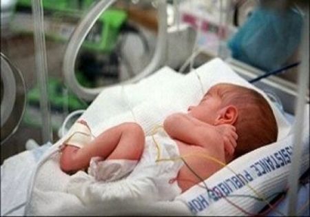 زایمان زودهنگام،اخبار پزشکی،خبرهای پزشکی زایمان زودهنگام،اخبار پزشکی،خبرهای پزشکی