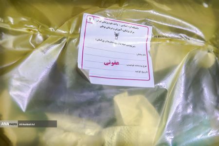 زبالههایی آلوده ،اخبار پزشکی ،خبرهای پزشکی زبالههایی آلوده,اخبار پزشکی ,خبرهای پزشکی