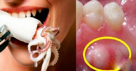 لقاح ماهی مرکب ،اخبارگوناگون,خبرهای گوناگون لقاح ماهی مرکب ,اخبارگوناگون,خبرهای گوناگون