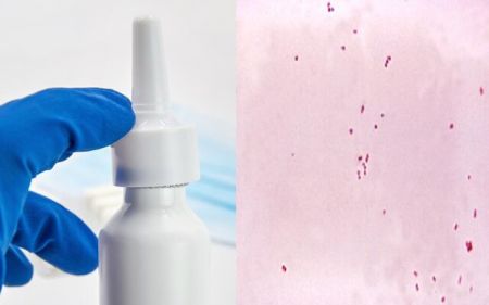 مننژیت،اخبار پزشکی ،خبرهای پزشکی مننژیت,اخبار پزشکی ,خبرهای پزشکی