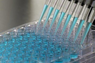 شناسایی نشانگر زیستی جدید برای تشخیص سرطان پانکراس،اخبار پزشکی،خبرهای پزشکی شناسایی نشانگر زیستی جدید برای تشخیص سرطان پانکراس،اخبار پزشکی،خبرهای پزشکی