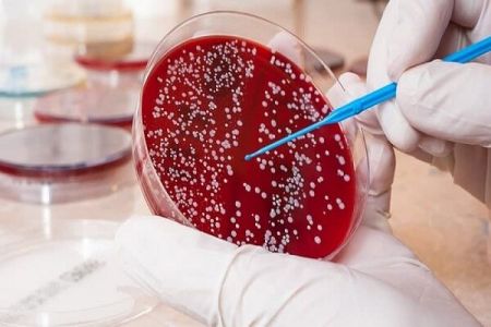 تعریق شبانه ،اخبار پزشکی ،خبرهای پزشکی تعریق شبانه,اخبار پزشکی ,خبرهای پزشکی