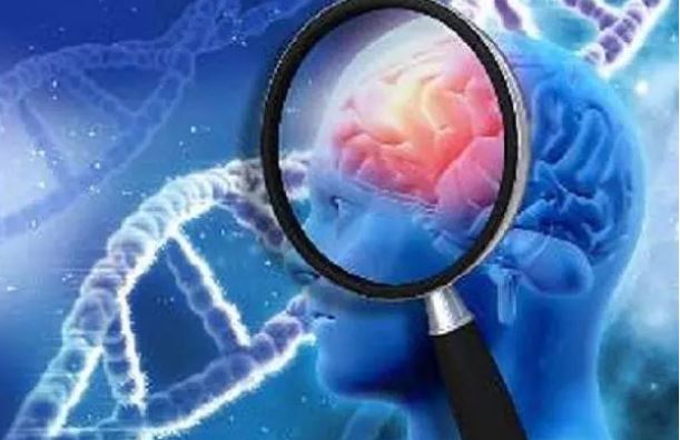 پلاک های آلزایمر،اخبار پزشکی ،خبرهای پزشکی پلاک های آلزایمر,اخبار پزشکی ,خبرهای پزشکی