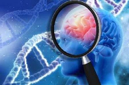 آلزایمر ،اخبار پزشکی ،خبرهای پزشکی آلزایمر ,اخبار پزشکی ,خبرهای پزشکی