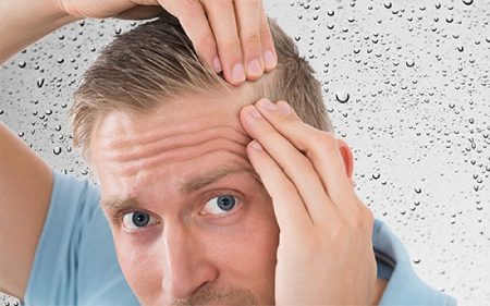 کاشت مو کاشت مو,کلینیک زیبایی,سایت پی جو