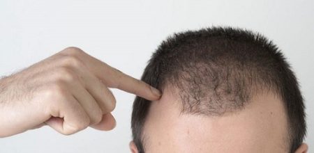 کاشت مو کاشت مو,کلینیک زیبایی,سایت پی جو