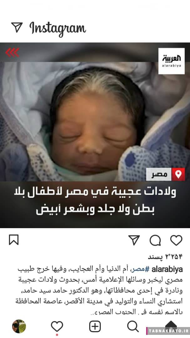 نوزادانی عجیب ،اخبارگوناگون,خبرهای گوناگون نوزادانی عجیب ,اخبارگوناگون,خبرهای گوناگون