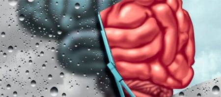 آلزایمر ،اخبار پزشکی ،خبرهای پزشکی آلزایمر ,اخبار پزشکی ,خبرهای پزشکی