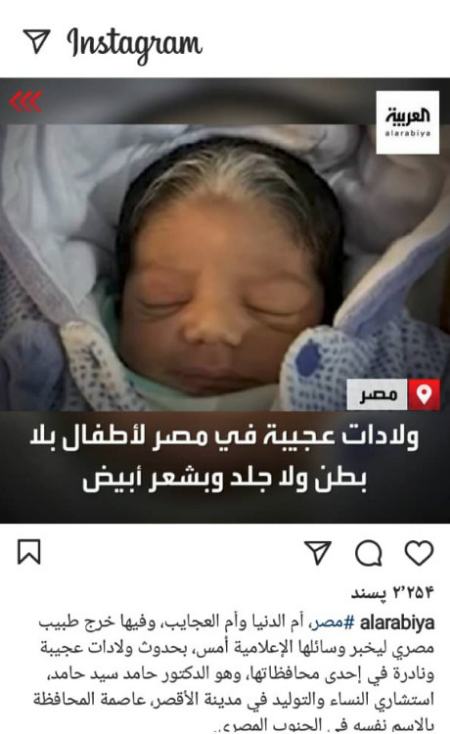 تولد نوزادانی عجیب در مصر،اخبار گوناگون،خبرهای گوناگون