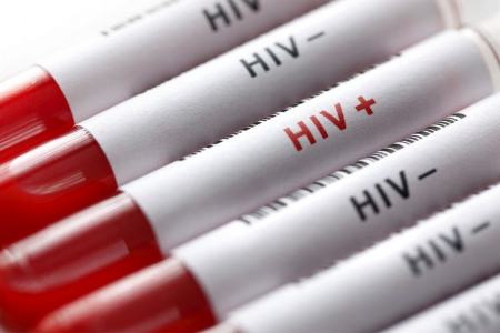 ماده کشنده ویروس HIV،اخبار پزشکی،خبرهای پزشکی