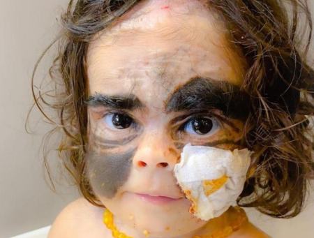 کودک صورت هیولایی،اخبارگوناگون,خبرهای گوناگون کودک صورت هیولایی,اخبارگوناگون,خبرهای گوناگون