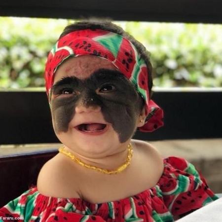 کودک صورت هیولایی،اخبارگوناگون,خبرهای گوناگون کودک صورت هیولایی,اخبارگوناگون,خبرهای گوناگون