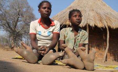 قبیله آفریقایی با پاهای عجیب و غریب،اخبار گوناگون،خبرهای گوناگون