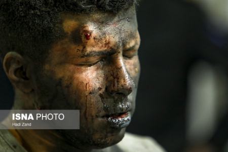 مصدومین چهارشنبه سوری 1400،عکس خبری،تصاویر خبری
