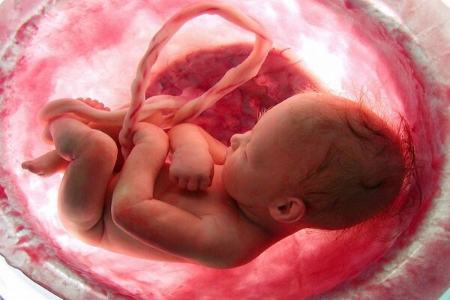 سقط جنین,اخبار پزشکی ,خبرهای پزشکی