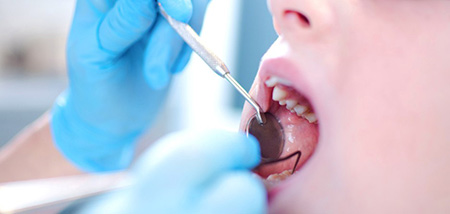 مراقبت از دندان، عادت های مناسب برای مراقبت از دندان،راه های مراقبت از دندان