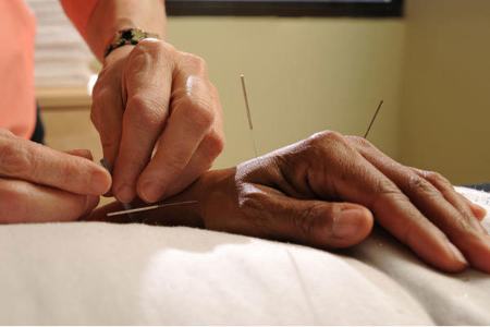 طب سوزنی ،اخبار پزشکی ،خبرهای پزشکی طب سوزنی,اخبار پزشکی ,خبرهای پزشکی