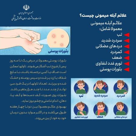 آبله میمونی،اخبار پزشکی ،خبرهای پزشکی آبله میمونی,اخبار پزشکی ,خبرهای پزشکی