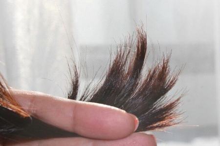 موخوره،اخبار پزشکی،خبرهای پزشکی موخوره،اخبار پزشکی،خبرهای پزشکی