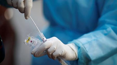 آزمایش PCR،اخبار پزشکی،خبرهای پزشکی آزمایش PCR،اخبار پزشکی،خبرهای پزشکی