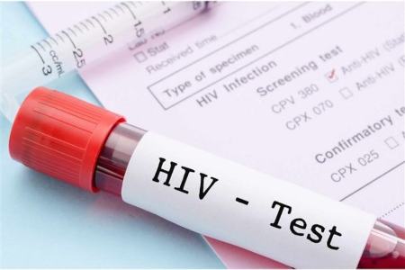 HIV ,اخبار پزشکی ,خبرهای پزشکی