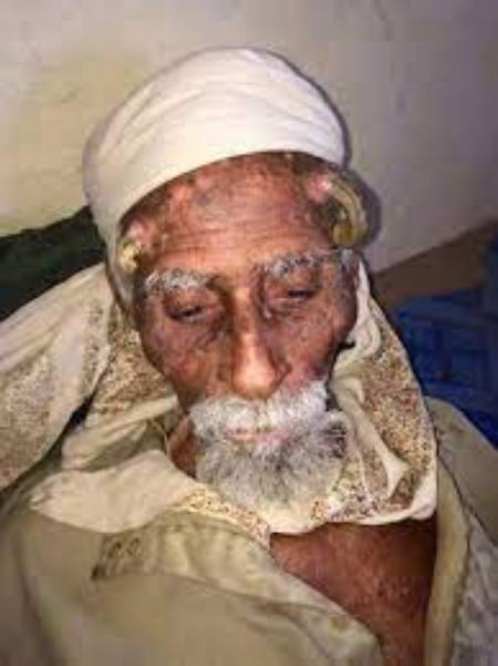 پیرمرد شاخ دار در یمن،اخبار گوناگون،خبرهای گوناگون