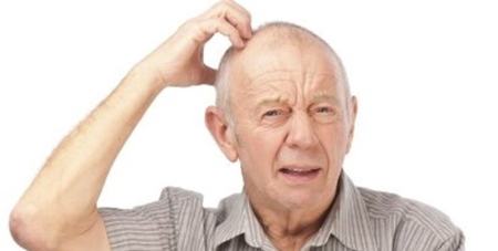  آلزایمر,اخبار پزشکی ,خبرهای پزشکی