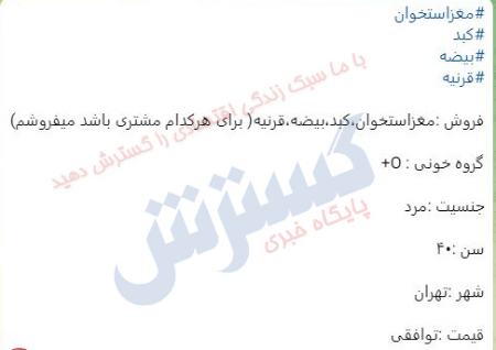 بازار سیاه فروش اعضای حیاتی بدن،اخبار اجتماعی،خبرهای اجتماعی